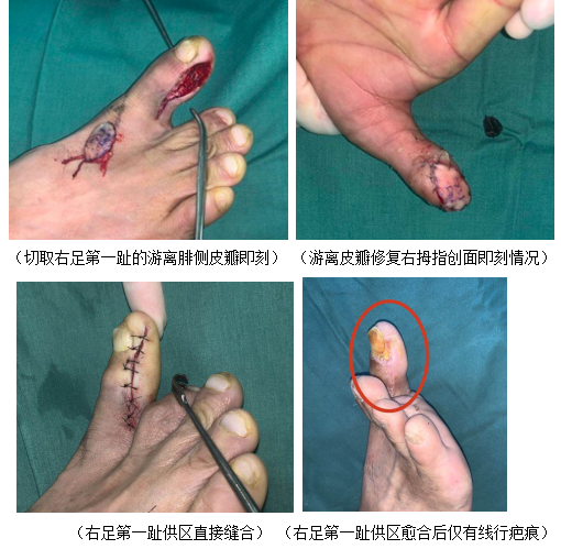 betway在线登陆手外科