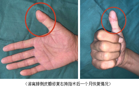 betway在线登陆手外科