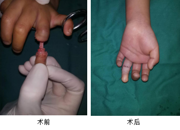 <a href='http://www.sararz.com/' target='_blank'><u>betway在线登陆</u></a>手外科