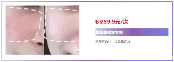 皮脂膜受损