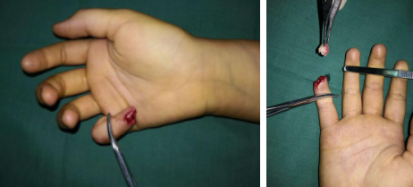 betway在线登陆手外科