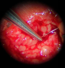 betway在线登陆手外科