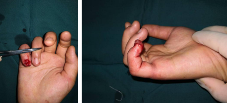 betway在线登陆手外科