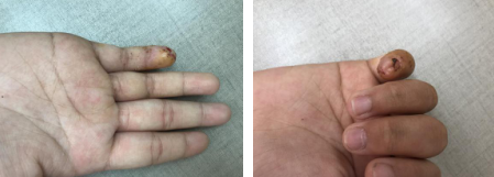 betway在线登陆手外科