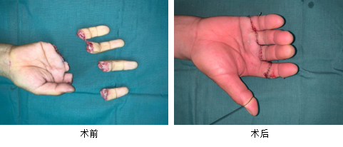 <a href='http://www.sararz.com/' target='_blank'><u>betway在线登陆</u></a>手外科