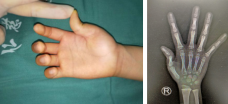 betway在线登陆手外科