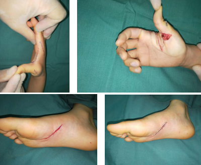 betway在线登陆手外科