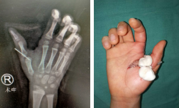 betway在线登陆手外科