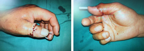 <a href='http://www.sararz.com/' target='_blank'><u>betway在线登陆</u></a>手外科