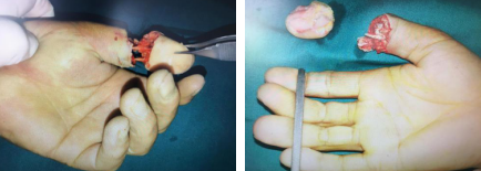 betway在线登陆手外科