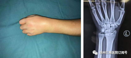 <a href='http://www.sararz.com/' target='_blank'><u>betway在线登陆</u></a>手外科