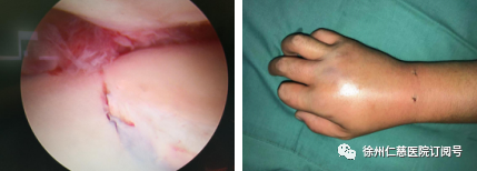 betway在线登陆手外科