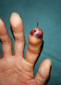 betway在线登陆手外科