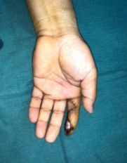 <a href='http://www.sararz.com/' target='_blank'><u>betway在线登陆</u></a>手外科