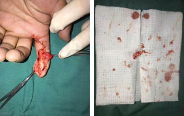 betway在线登陆手外科