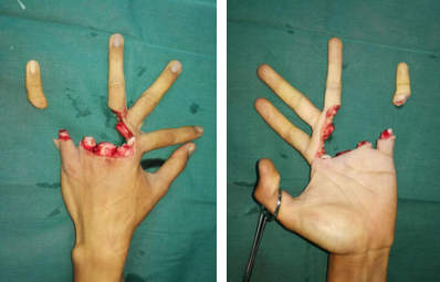 <a href='http://www.sararz.com/' target='_blank'><u>betway在线登陆</u></a>手外科