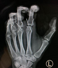 betway在线登陆手外科