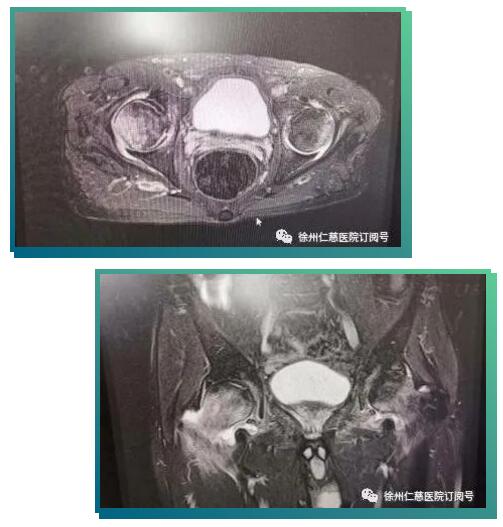 sararz骨科机器人