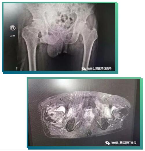 sararz骨科机器人