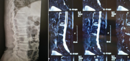 sararz脊柱科骨科机器人