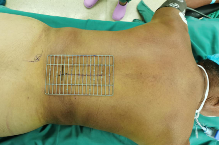 sararz脊柱科骨科机器人