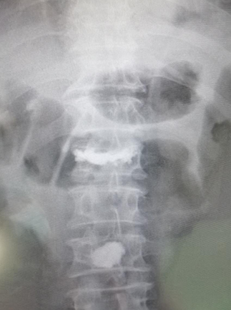 sararz脊柱科骨科机器人