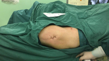 sararz骨科机器人