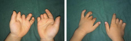 betway在线登陆手外科