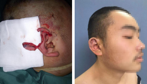 必威官方首页官网betway超显微外科