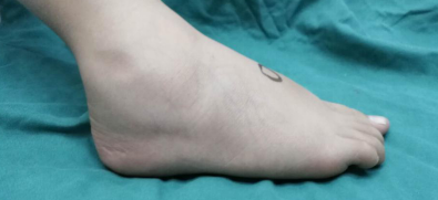 betway在线登陆足踝科