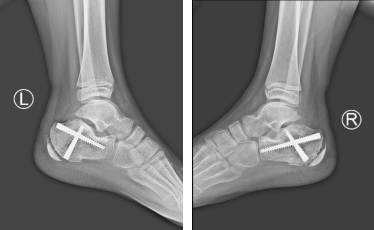 betway在线登陆足踝科