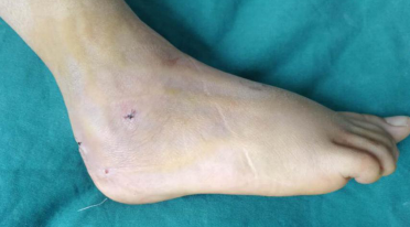 betway在线登陆足踝科