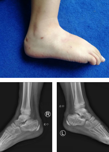betway在线登陆足踝科