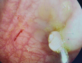 betway在线登陆消化内镜