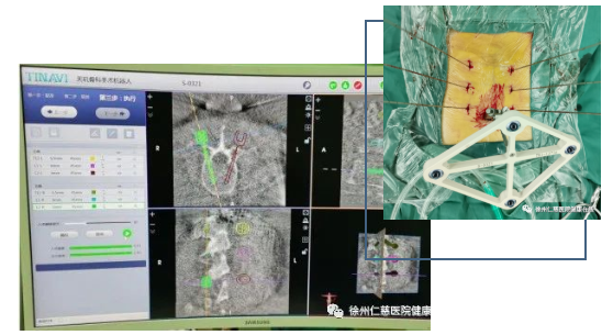sararz骨科机器人