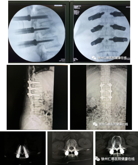 sararz骨科机器人