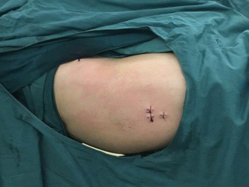 sararz骨科机器人