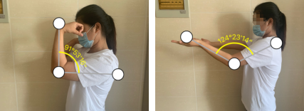 必威官方首页官网betway肘关节镜