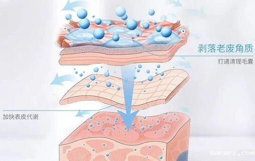 黑头