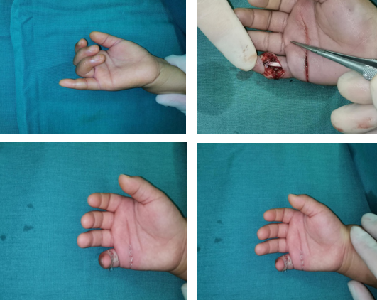 betway在线登陆手外科