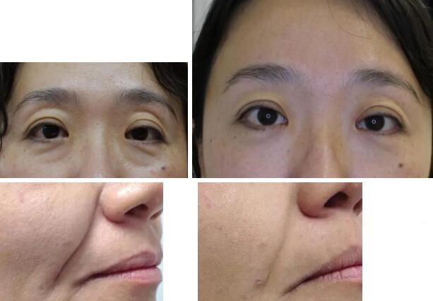 <a href='http://www.xzrcym.com/' target='_blank'><u>sararz医美</u></a>