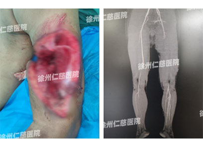 betway在线登陆臂丛神经