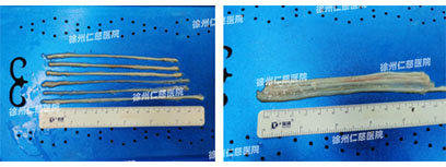 betway在线登陆臂丛神经