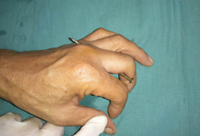 betway在线登陆手外科