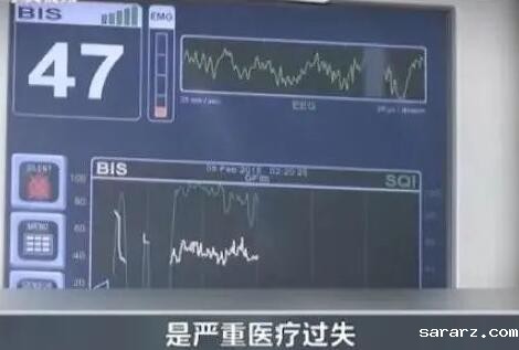 韩国整容