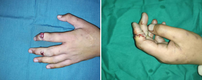 betway在线登陆手外科