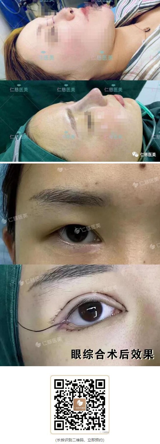 刘凯