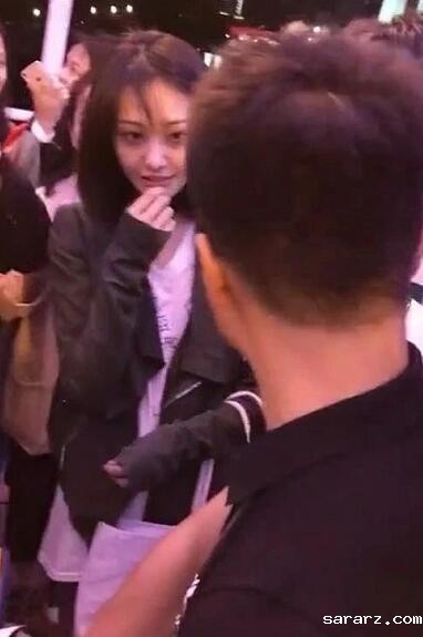 黑眼圈