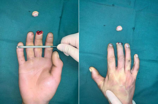 必威官方首页官网betway手外科