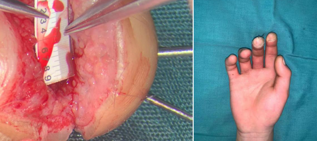 必威官方首页官网betway手外科